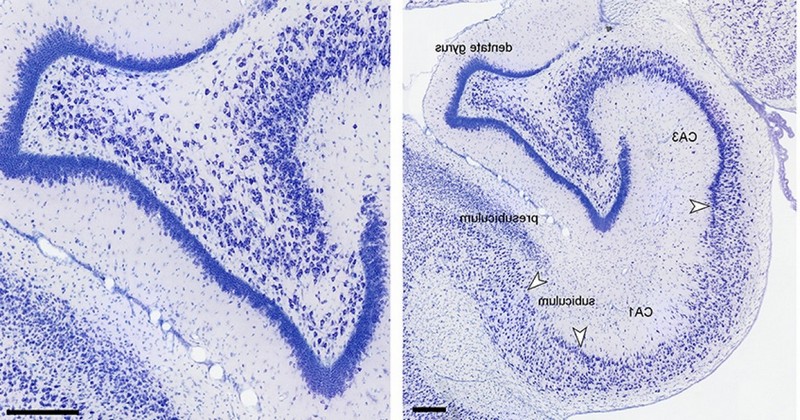 Dentate gyrus: what is it and what functions does it play in the brain?