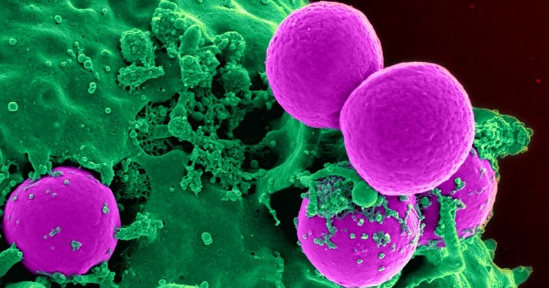 The 3 types of bacteria (characteristics and morphology)