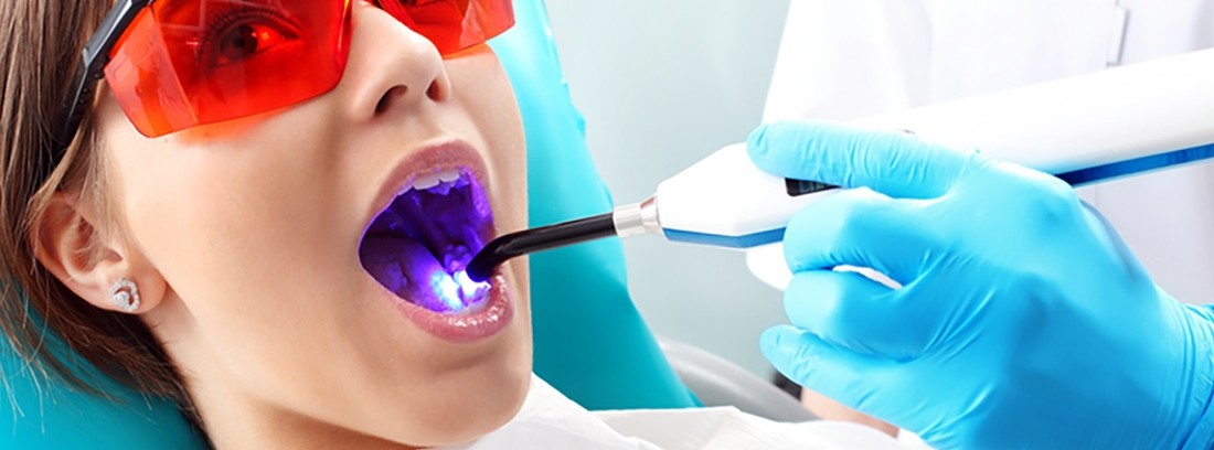 Dental laser therapy