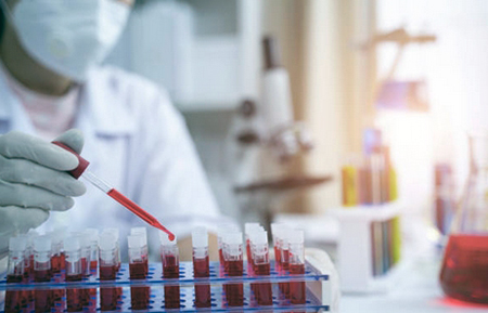 erythremia diagnosis tests