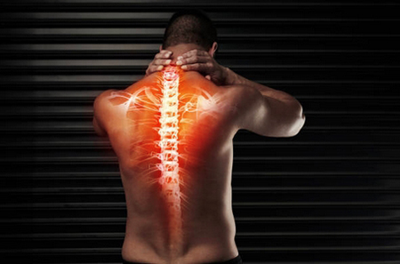 Causes of pinched nerve (radiculopathy)