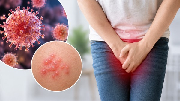 Genital Herpes: Diagnosis, Treatment and Transmission Genital Herpes: Diagnosis, Treatment and Transmission