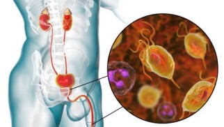 What are urinary tract infections and how are they treated?