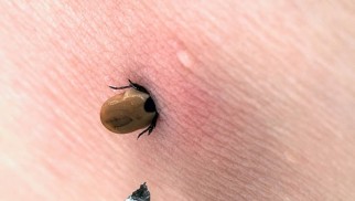 What is Lyme disease and how is it treated?