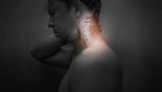 What is spondylosis and how is it treated?