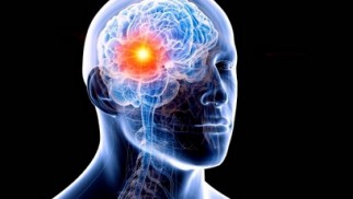 What are brain tumors and how are they treated?